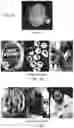 Fig. 04 - Weakly supervised learning for classifying images