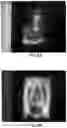 Fig. 13 - Device and method for optically encoding an image