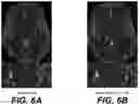 Fig. 08 - Neural network evolution using expedited genetic algorithm for medical image denoising