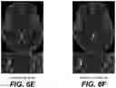Fig. 10 - Neural network evolution using expedited genetic algorithm for medical image denoising