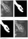 Fig. 03 - X-ray exposure area regulation method, a storage medium, and an x-ray system