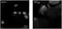 Fig. 01 - Systems and methods for using a single-cell to create chromosomal spreads