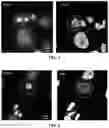 Fig. 02 - Systems and methods for using a single-cell to create chromosomal spreads