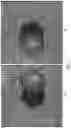 Fig. 03 - Methods and apparatus for efficient data processing of initial correspondence assignments for three-dimensional reconstruction of an object