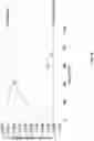 Fig. 13 - Wearable inductive damping sensor