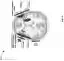 Fig. 15 - Wearable inductive damping sensor