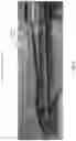 Fig. 05 - Method and system for automatically tracking and managing inventory of surgical tools in operating rooms