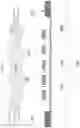 Fig. 05 - Method for dicing die attach film
