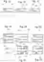 Fig. 02 - Component Carrier With a Photoimageable Dielectric Layer and a Structured Conductive Layer Being Used as a Mask for Selectively Exposing the Photoimageable Dielectric Layer With Electromagnetic Radiation
