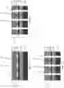 Fig. 12 - Methods for wafer-to-wafer bonding