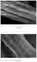 Fig. 03 - LINEAR HIERARCHICAL STRUCTURE LITHIUM TITANATE MATERIAL, PREPARATION AND APPLICATION THEREOF