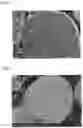 Fig. 03 - Positive electrode active material for lithium secondary battery, positive electrode for lithium secondary battery, and lithium secondary battery