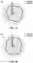 Fig. 07 - Dual-feed loop antenna structure and electronic device