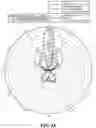 Fig. 17 - Dielectric resonator antenna system