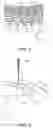 Fig. 03 - LASER WELDING METHOD FOR COIL WIRES