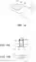 Fig. 09 - LASER WELDING METHOD FOR COIL WIRES