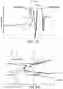 Fig. 11 - Two-stage lateral bulk acoustic wave filter