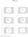 Fig. 04 - Blur correction device, endoscope apparatus, and blur correction method