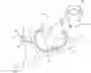 Fig. 01 - Stereoscopic mobile retinal imager