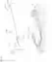 Fig. 06 - Stereoscopic mobile retinal imager