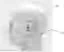 Fig. 01 - Hearing aid for placement at an ear of a user
