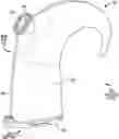 Fig. 01 - Hearing prosthesis accessory
