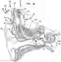 Fig. 02 - Hearing prosthesis accessory