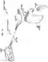 Fig. 04 - Hearing prosthesis accessory