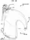 Fig. 06 - Hearing prosthesis accessory