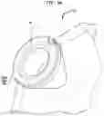 Fig. 10 - Hearing prosthesis accessory
