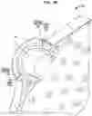 Fig. 11 - Hearing prosthesis accessory