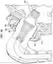 Fig. 12 - Hearing prosthesis accessory