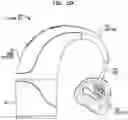Fig. 24 - Hearing prosthesis accessory