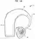 Fig. 27 - Hearing prosthesis accessory