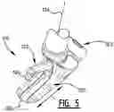 Fig. 09 - Knotter system for a baler