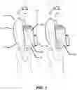 Fig. 02 - Methods and apparatus for a self contained expandable pet carrier