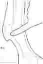 Fig. 04 - EQUID WEARABLE DEVICE, PERFORMANCE ANALYTICS SYSTEM AND METHODS THEREOF