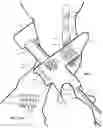 Fig. 12 - EQUID WEARABLE DEVICE, PERFORMANCE ANALYTICS SYSTEM AND METHODS THEREOF