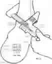 Fig. 13 - EQUID WEARABLE DEVICE, PERFORMANCE ANALYTICS SYSTEM AND METHODS THEREOF
