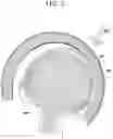 Fig. 03 - Rotation damping helmet