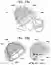 Fig. 23 - Rotation damping helmet
