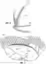 Fig. 06 - Bicycle helmet fit system