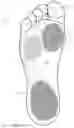 Fig. 02 - REUSABLE CUSTOM INSOLES