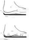 Fig. 05 - REUSABLE CUSTOM INSOLES