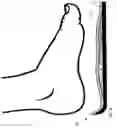 Fig. 11 - REUSABLE CUSTOM INSOLES