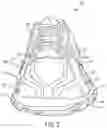 Fig. 03 - ARTICLE OF FOOTWEAR WITH EXTRUDED COMPONENTS