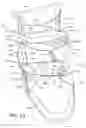 Fig. 04 - Zonal dynamic lacing system