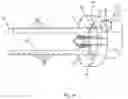 Fig. 15 - Magnetic zipper