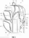 Fig. 02 - Backpack carrier
