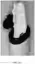 Fig. 16 - WET WIPE LID WITH 3D ANGLED WALL KEYHOLE SQUEEGEE